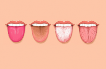 7 coisas que sua língua está tentando dizer sobre sua saúde
