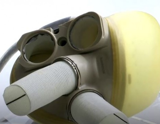 Europa aprova venda do primeiro coração artificial: é o mais avançado do mundo